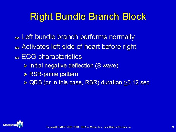 Right Bundle Branch Block Left bundle branch performs normally Activates left side of heart