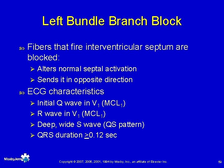 Left Bundle Branch Block Fibers that fire interventricular septum are blocked: Alters normal septal