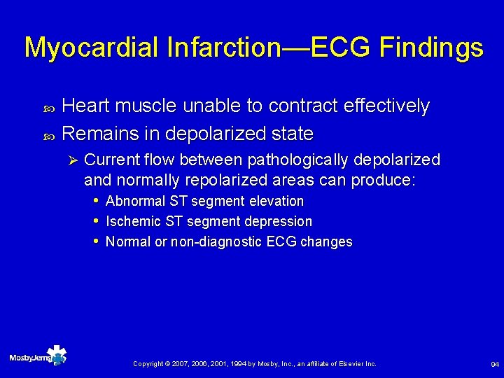 Myocardial Infarction—ECG Findings Heart muscle unable to contract effectively Remains in depolarized state Ø