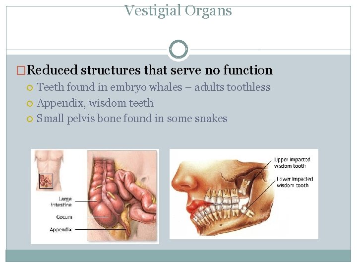 Vestigial Organs �Reduced structures that serve no function Teeth found in embryo whales –
