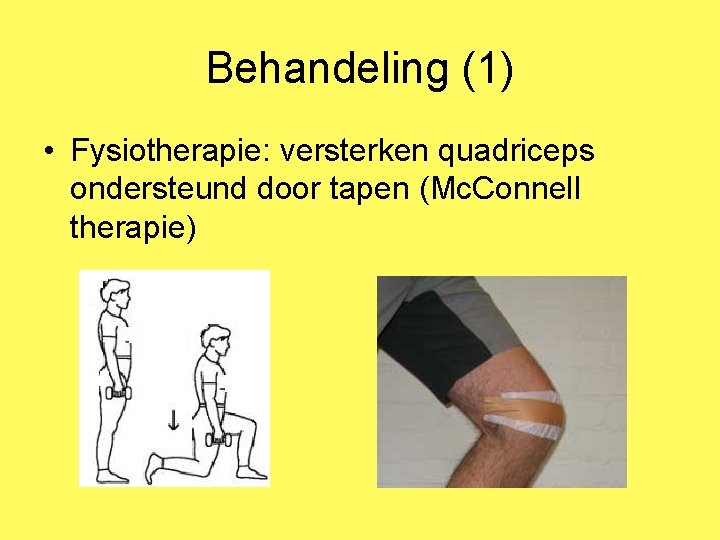 Behandeling (1) • Fysiotherapie: versterken quadriceps ondersteund door tapen (Mc. Connell therapie) 