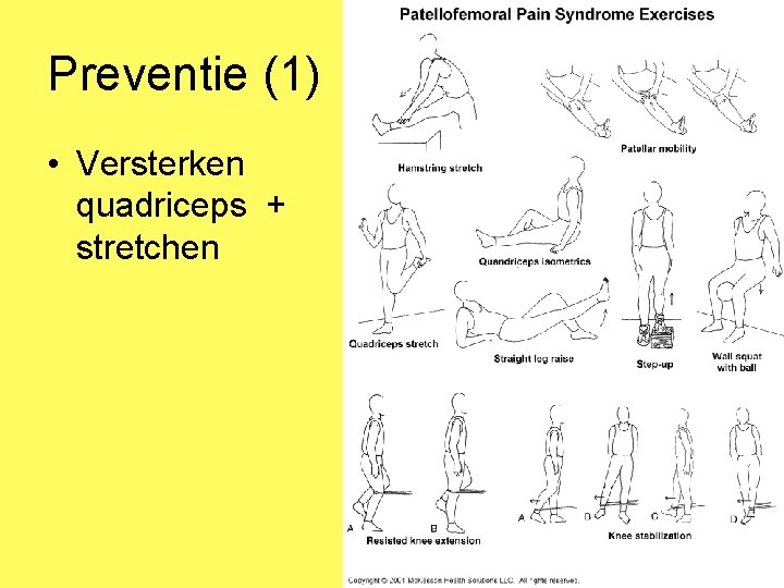 Preventie (1) • Versterken quadriceps + stretchen 