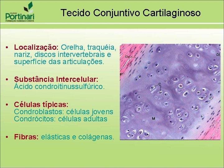 Tecido Conjuntivo Cartilaginoso • Localização: Orelha, traquéia, nariz, discos intervertebrais e superfície das articulações.