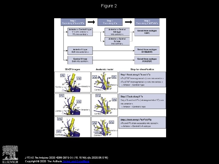 Figure 2 JTCVS Techniques 2020 4288 -297 DOI: (10. 1016/j. xjtc. 2020. 08. 018)