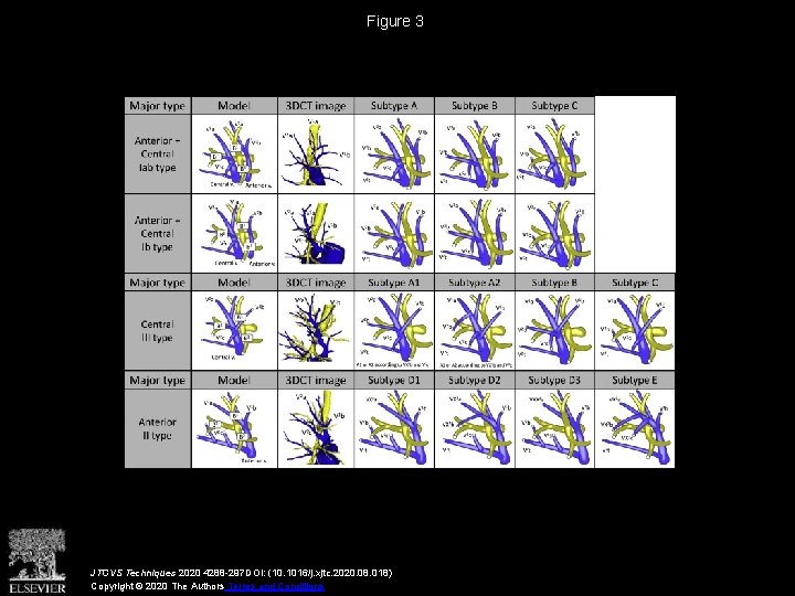 Figure 3 JTCVS Techniques 2020 4288 -297 DOI: (10. 1016/j. xjtc. 2020. 08. 018)