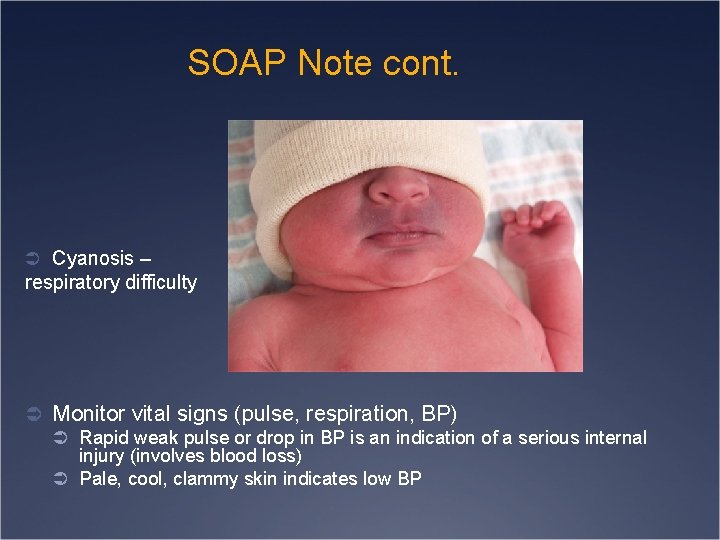 SOAP Note cont. Ü Cyanosis – respiratory difficulty Ü Monitor vital signs (pulse, respiration,