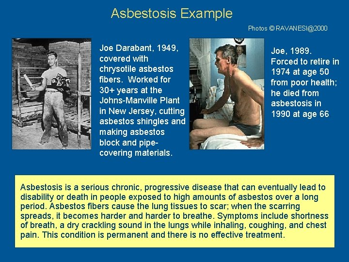 Asbestosis Example Photos © RAVANESI@2000 Joe Darabant, 1949, covered with chrysotile asbestos fibers. Worked