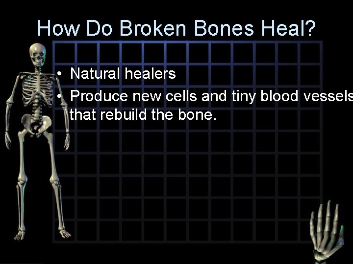 How Do Broken Bones Heal? • Natural healers • Produce new cells and tiny