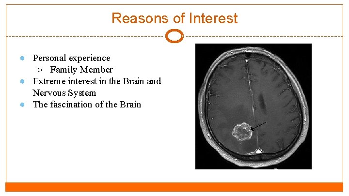 Reasons of Interest ● Personal experience ○ Family Member ● Extreme interest in the