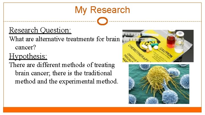 My Research Question: What are alternative treatments for brain cancer? Hypothesis: There are different