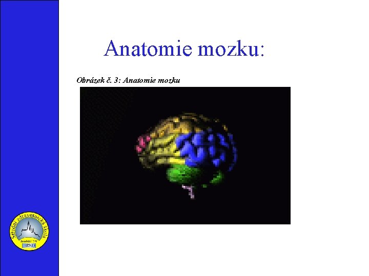 Anatomie mozku: Obrázek č. 3: Anatomie mozku 