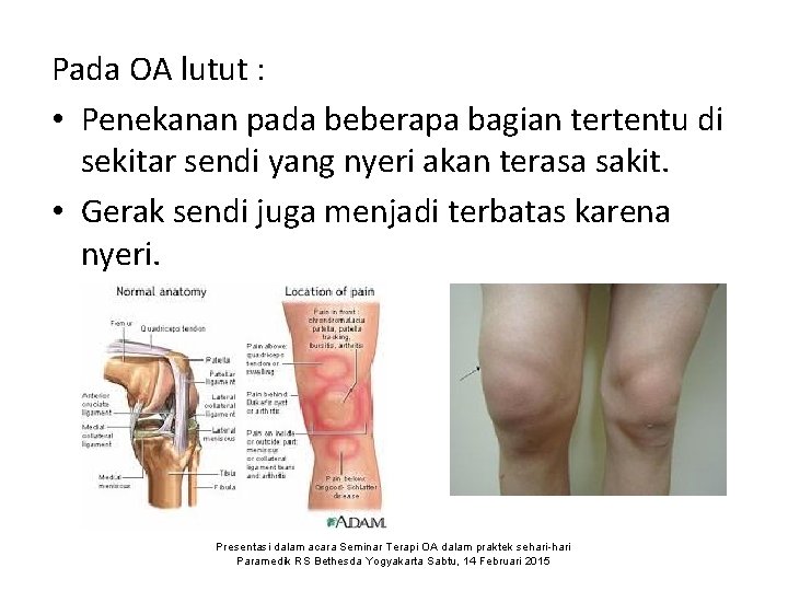 Pada OA lutut : • Penekanan pada beberapa bagian tertentu di sekitar sendi yang