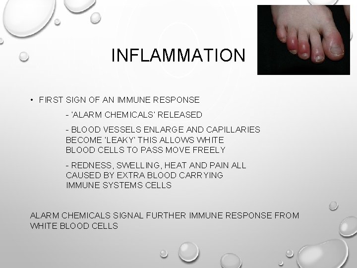 INFLAMMATION • FIRST SIGN OF AN IMMUNE RESPONSE - ‘ALARM CHEMICALS’ RELEASED - BLOOD