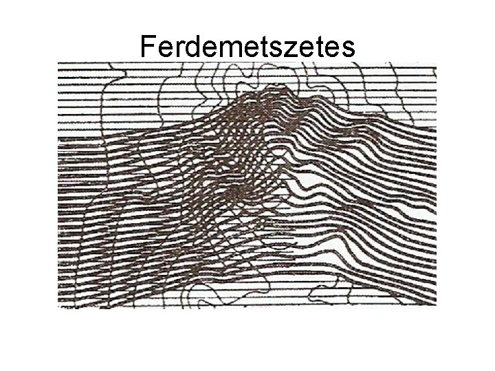 Ferdemetszetes 