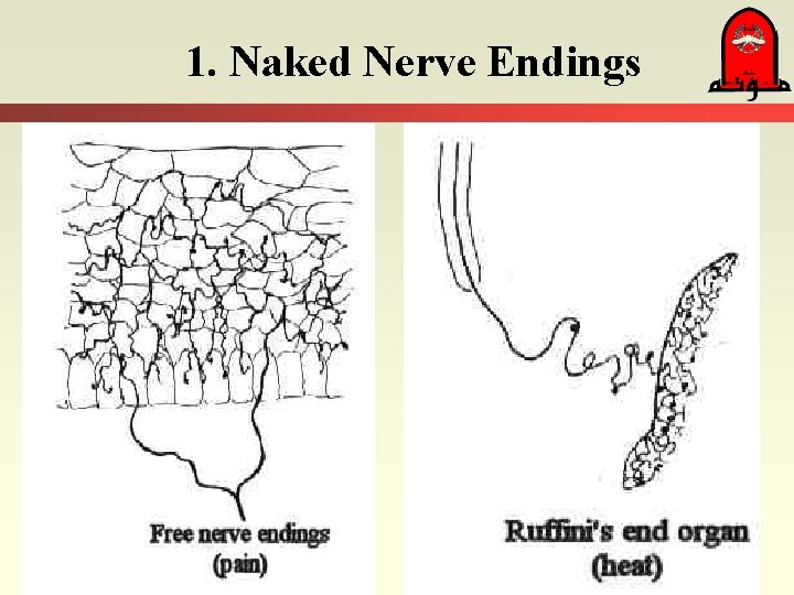 1. Naked Nerve Endings 