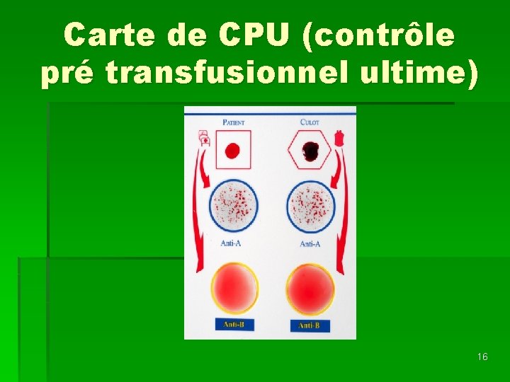 Carte de CPU (contrôle pré transfusionnel ultime) 16 