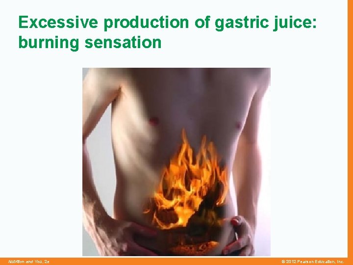 Excessive production of gastric juice: burning sensation Nutrition and You, 2 e © 2012