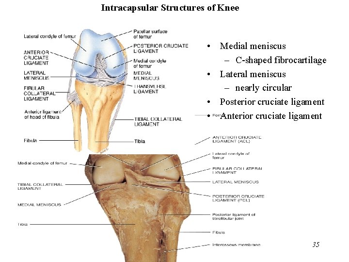 Intracapsular Structures of Knee • Medial meniscus – C-shaped fibrocartilage • Lateral meniscus –