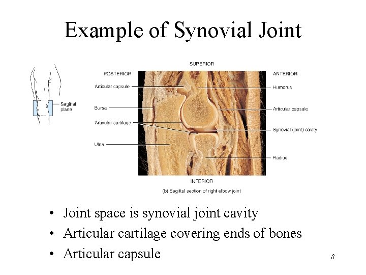 Example of Synovial Joint • Joint space is synovial joint cavity • Articular cartilage