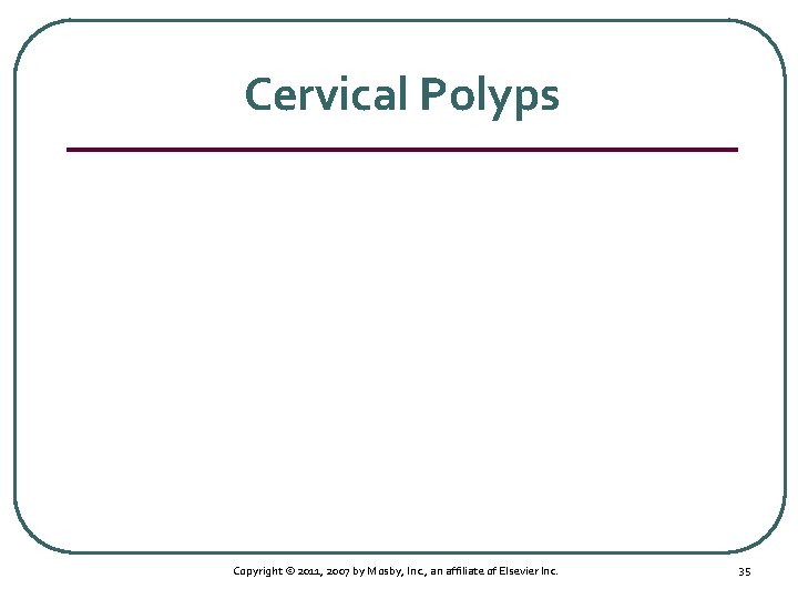 Cervical Polyps Copyright © 2011, 2007 by Mosby, Inc. , an affiliate of Elsevier