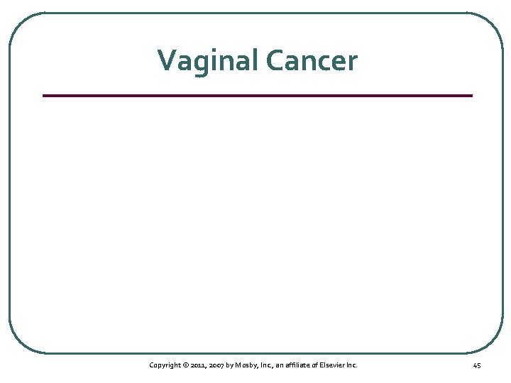 Vaginal Cancer Copyright © 2011, 2007 by Mosby, Inc. , an affiliate of Elsevier