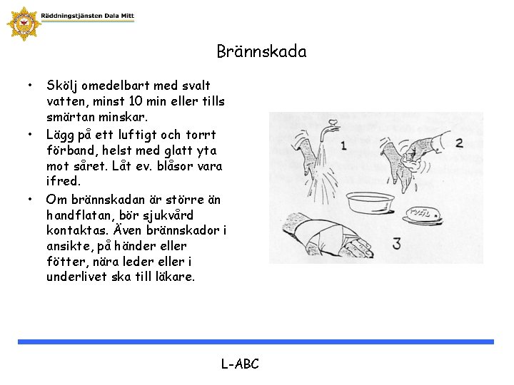 Brännskada • • • Skölj omedelbart med svalt vatten, minst 10 min eller tills