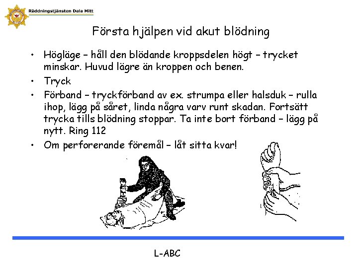 Första hjälpen vid akut blödning • Högläge – håll den blödande kroppsdelen högt –