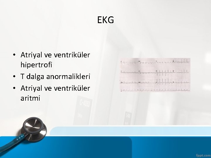 EKG • Atriyal ve ventriküler hipertrofi • T dalga anormalikleri • Atriyal ve ventriküler