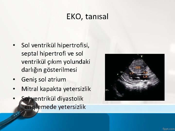 EKO, tanısal • Sol ventrikül hipertrofisi, septal hipertrofi ve sol ventrikül çıkım yolundaki darlığın