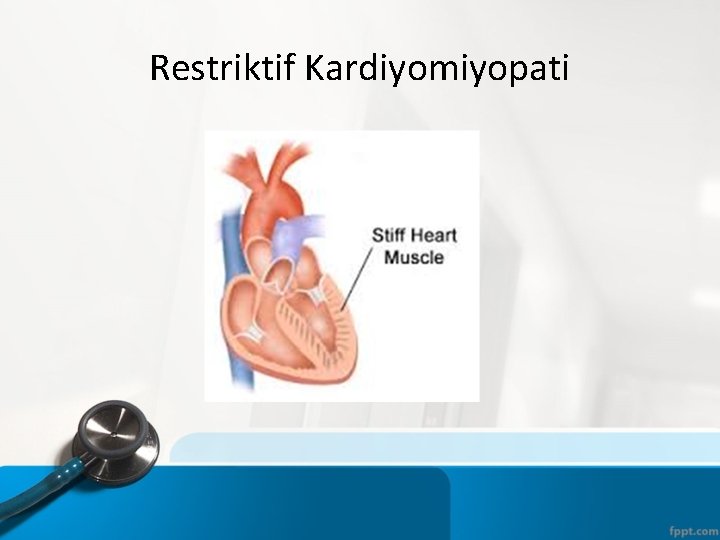 Restriktif Kardiyomiyopati 