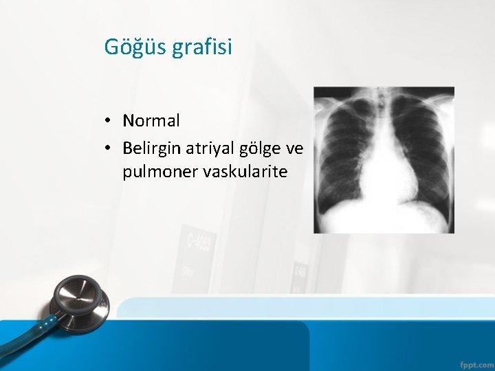 Göğüs grafisi • Normal • Belirgin atriyal gölge ve pulmoner vaskularite 