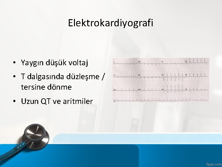 Elektrokardiyografi • Yaygın düşük voltaj • T dalgasında düzleşme / tersine dönme • Uzun