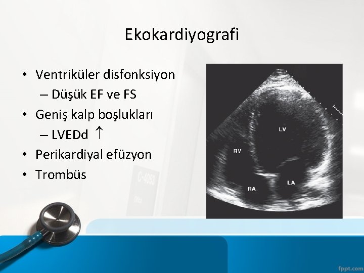 Ekokardiyografi • Ventriküler disfonksiyon – Düşük EF ve FS • Geniş kalp boşlukları –