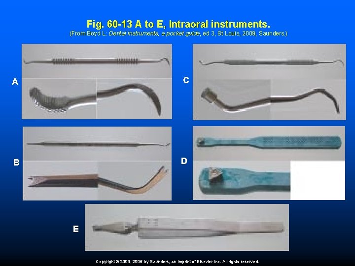 Fig. 60 -13 A to E, Intraoral instruments. (From Boyd L: Dental instruments, a
