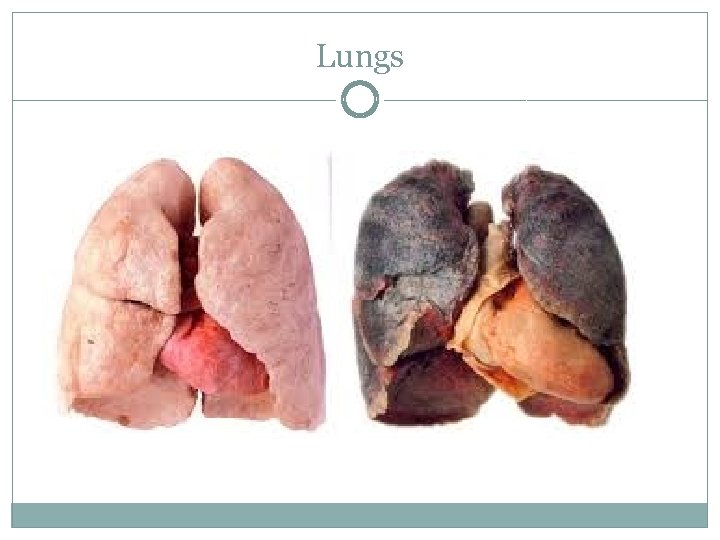 Lungs 