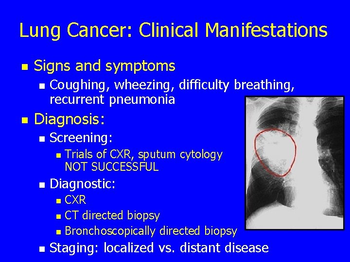 Lung Cancer: Clinical Manifestations n Signs and symptoms n n Coughing, wheezing, difficulty breathing,