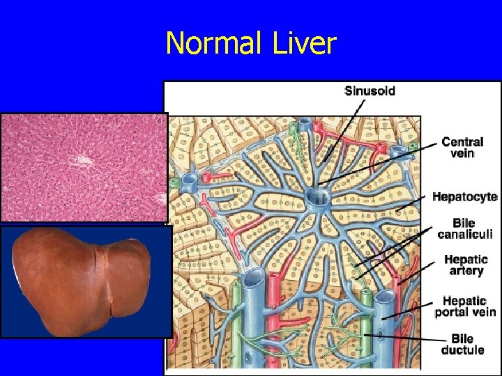 Normal Liver 
