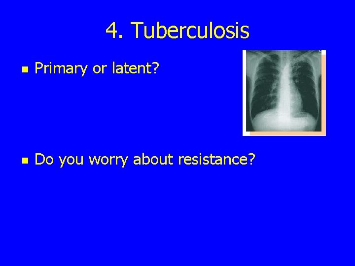 4. Tuberculosis n Primary or latent? n Do you worry about resistance? 