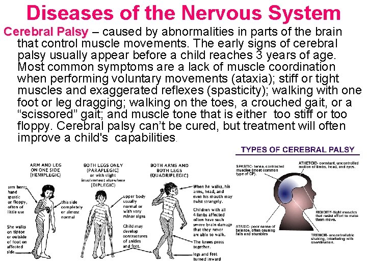 Diseases of the Nervous System Cerebral Palsy – caused by abnormalities in parts of