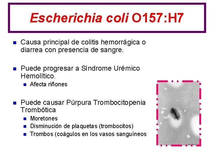 Escherichia coli O 157: H 7 n Causa principal de colitis hemorrágica o diarrea