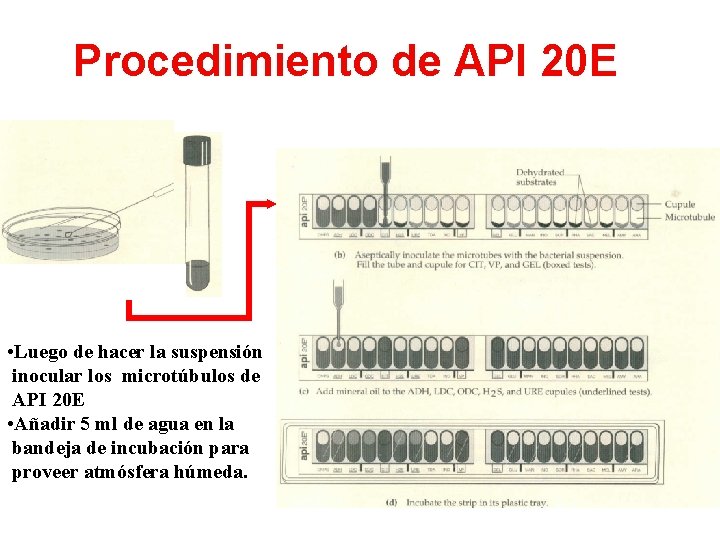 Procedimiento de API 20 E • Luego de hacer la suspensión inocular los microtúbulos