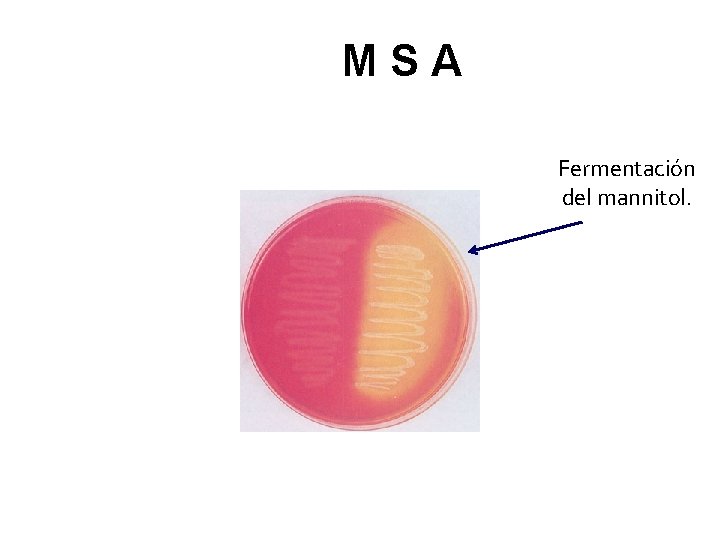 MSA Fermentación del mannitol. 