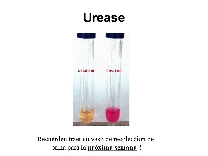 Urease Recuerden traer su vaso de recolección de orina para la próxima semana!! 