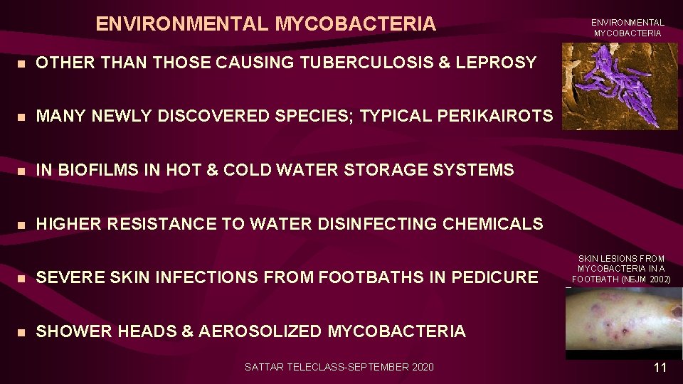 ENVIRONMENTAL MYCOBACTERIA n OTHER THAN THOSE CAUSING TUBERCULOSIS & LEPROSY n MANY NEWLY DISCOVERED