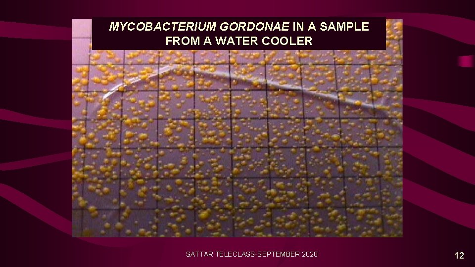 MYCOBACTERIUM GORDONAE IN A SAMPLE FROM A WATER COOLER SATTAR TELECLASS-SEPTEMBER 2020 12 