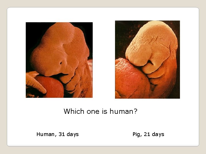Which one is human? Human, 31 days Pig, 21 days 