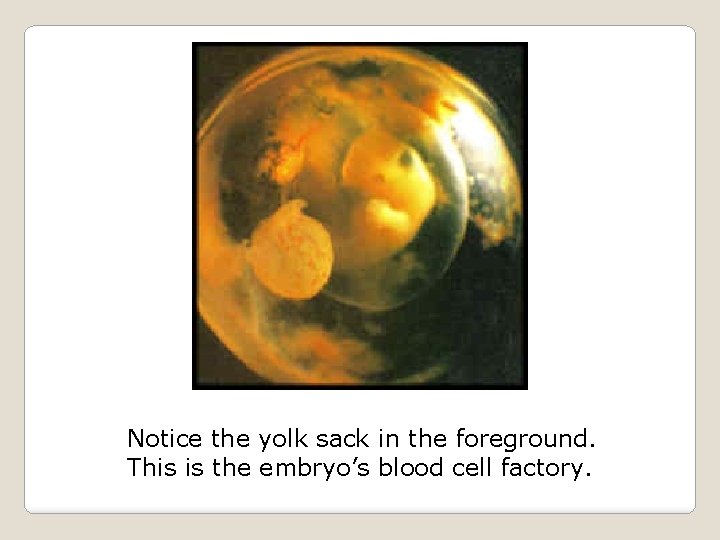 Notice the yolk sack in the foreground. This is the embryo’s blood cell factory.