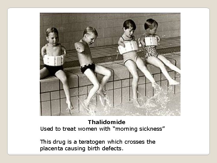 Thalidomide Used to treat women with “morning sickness” This drug is a teratogen which
