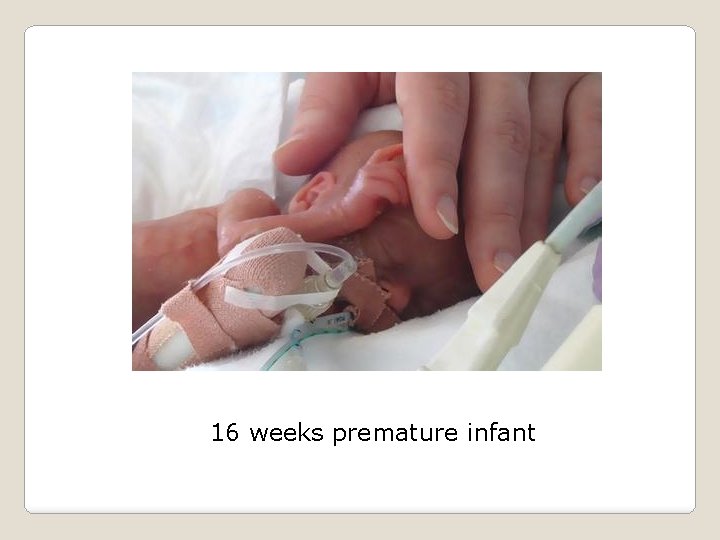 16 weeks premature infant 