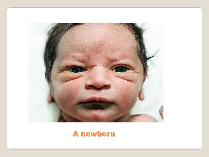 A newborn 